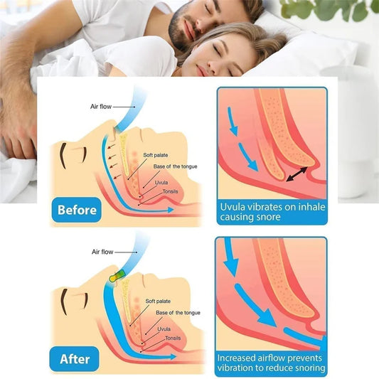 Anti-Snoring Nose Clip – Comfortable Snore-Prevention Device for Men & Women